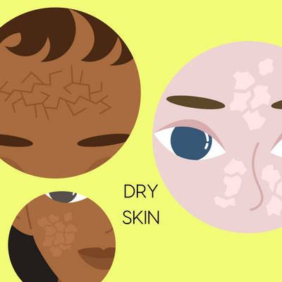 Dry Skin: The Best Skincare Routine